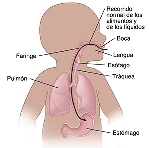 Contorno del aparato digestivo superior de un bebé y del recorrido normal de los alimentos y los líquidos.