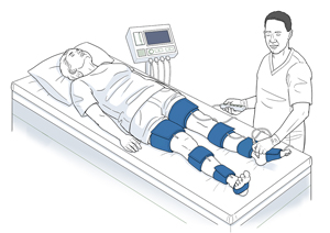 Persona acostada en una mesa de examinación con manguitos del tensiómetro en los muslos, en las pantorrillas, en los tobillos y en los pies. Proveedor de atención médica presionando un instrumento sobre el pie del paciente.