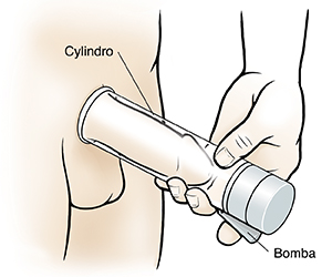 Hombre que se coloca una bomba de vacío en el pene.